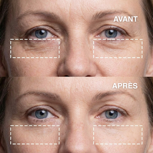 Patchs anti-rides pour les yeux